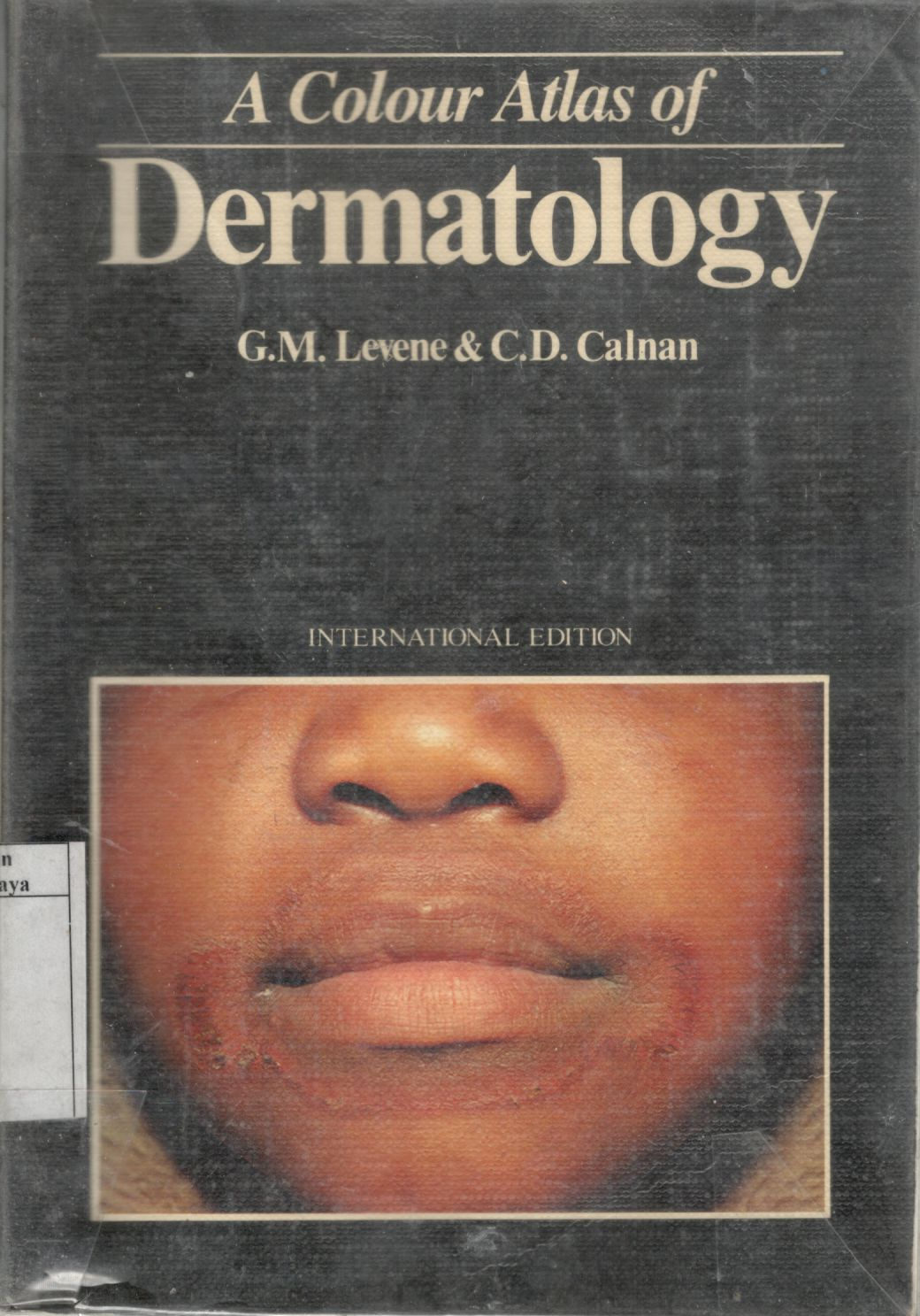 A Colour atlas of angina pectoris / L. M. Shapiro. C. A. Warnes . K. M. Fox 