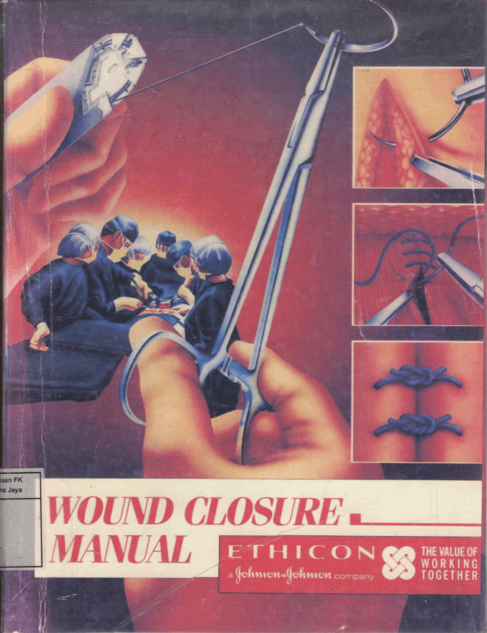 Ethicon wound closure manual 